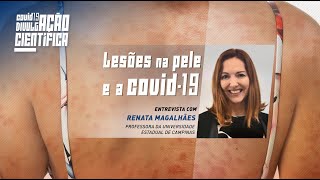 Lesões na pele e a COVID19 [upl. by Varin239]