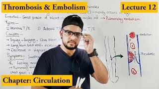 Thrombosis amp Embolism Cardiovascular Disorder  Chapter circulation  Video  12 [upl. by Ilek334]