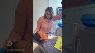 IPR UYGULAMASI NEDİR invisalign keşfetteyiz dentist newvideo ciltbakımı keşfet ortodonti [upl. by Norris792]