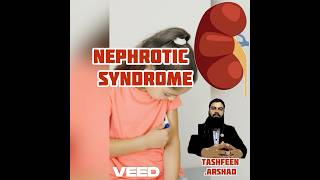 Nephrotic Syndrome awareness  Dr Tashfeen Child Specialist nephroticsyndrome kidneydisorder [upl. by Kciredorb494]