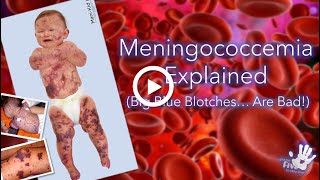 Meningococcemia Explained [upl. by Shapiro]