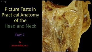 Picture tests in head and neck anatomy 7 [upl. by Lamond]