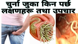 Pin worm infectionIn Nepali चुर्ना कसरी पर्छयसका कारण लक्षणहरू र उपचार सम्पूर्ण जानकारी [upl. by Matthaus]