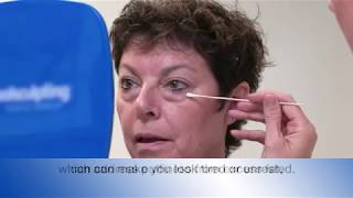 What happens during a lower eyelid surgery [upl. by Adnov]