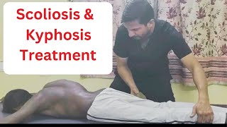 Sపార్శ్వగూని మరియు కైఫోసిస్ చికిత్సscoliosis amp Kyphosis treated by Indian chiropractor 7023645760 [upl. by Ahseiyk]