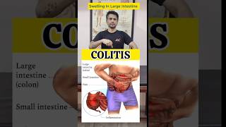 Best Exercise for COLITIS swelling in large intestine Relief shorts tranding [upl. by Aaren906]