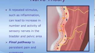 Understanding Interstitial Cystitis ICPainful Bladder Syndrome PBS [upl. by Aver]