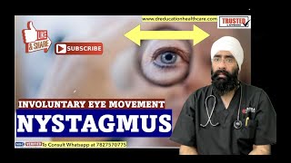 एक आँख हिलती है  Nystagmus  Involuntary Eye Movement  DrEducation [upl. by Barclay]