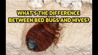 Whats The Difference Between Bed Bugs And Hives [upl. by Odericus994]