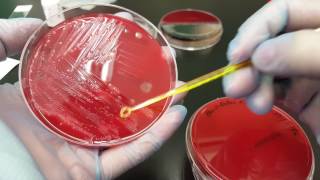 Microbiology Bacteroides fragilis biochemical testing and colonial growth [upl. by Einhpad]