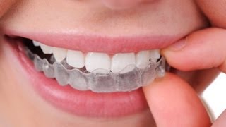 Ortodoncia invisible Inicia INVISALIGN [upl. by Armahs]