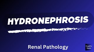 Hydronephrosis  Renal Pathology  Robbins  Easy Explanation [upl. by Yadsnil]