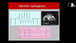 SINCOPE Y ESTIMULACION CARDIACA [upl. by Lanti563]