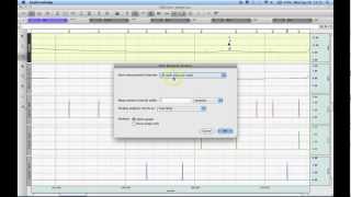 Stim Response Analysis [upl. by Kerat]