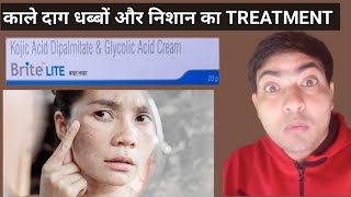 Brite lite cream use in hindi  Brite lite cream review [upl. by Shir]