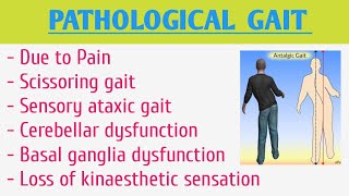 Pathological Gait [upl. by Rapsag417]