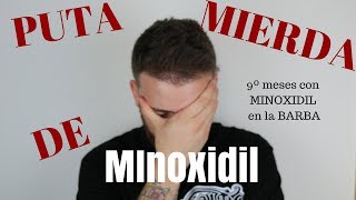 9º Meses con MINOXIDIL PUTA MIERDA DE MINOXIDIL [upl. by Ardnod]