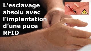 Lesclavage absolu avec limplantation dune puce RFID [upl. by Odnamla298]