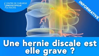 HERNIE DISCALE  Estelle grave [upl. by Aicxela455]