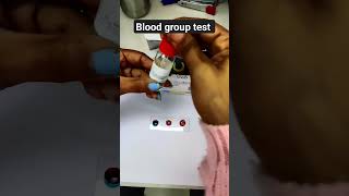 Blood group O positive test learning medicalstudent lablife hospital hospitallife shorts [upl. by Rramal]