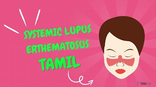 Systemic Lupus Erythematosus SLE in Tamil Definition Symptoms Causes Diagnosis and Management [upl. by Xela]