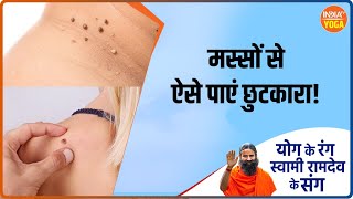 Yoga Sawal शरीर पर हो रहे मस्सों से अब ना होंगे आप और परेशान  IndiaTV Yoga  Swami Ramdev [upl. by Akired]