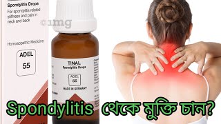 Spondylitis থেকে মুক্তি পেতে কি করবেন admission going on  DMBSBEMSCMSampED9564412063 [upl. by Ahsert825]