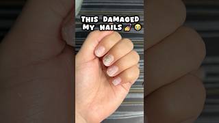 Nail extensions ki galti 😭😭nails nailsextension viralvideo shortsfeed viralshort trending [upl. by Adriano]