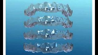 Invisalign digital animation [upl. by Llerret]