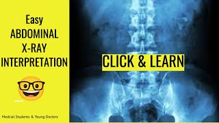 ✅ Normal Abdominal Xray Interpretation Dont Miss a Diagnosis [upl. by Alol]