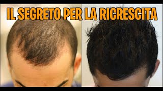 TOP 10 prodotti per far ricrescere i capelli [upl. by Wieren]