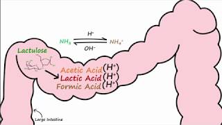 Hepatic Encephalopathy and Lactulose [upl. by Sandy]