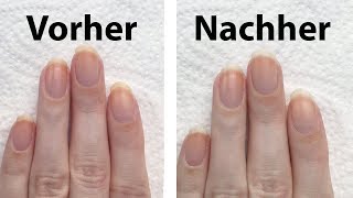 3 Tipps im Test um vergilbte Fingernägel aufzuhellen  seni Nageldesign [upl. by Yrem101]