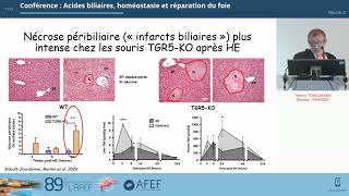 Acides biliaires homéostasie et réparation du foie  T TORDJMANN [upl. by Calder104]