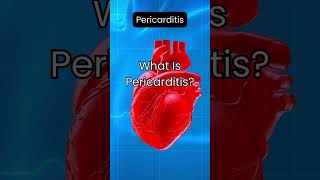 What Is Pericarditis [upl. by Bust]