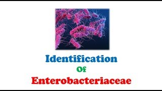 Microbiology 🔤  Biochemical Tests and Identification of Enterobacteriaceae [upl. by Carman]