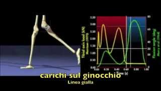 Analisi della deambulazione  carichi sul ginocchio [upl. by Seabrook265]