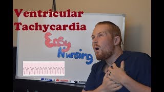 Ventricular Tachycardia  NCLEX Review [upl. by Hansen]