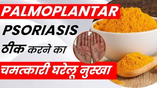 Palmoplantar Psoriasis का उपचार कैसे करे Palmoplantar Psoriasis Natural Treatment in Hindi [upl. by Duvall708]