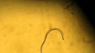 Strongyloides stercoralis filariform larvae [upl. by Barling132]