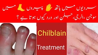 Treatment of Chilblains swellingpain  Allergies redness [upl. by Halima]