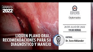 Webinar Liquen Plano Oral Recomendaciones para su Diagnóstico y Manejo [upl. by Jeffries606]