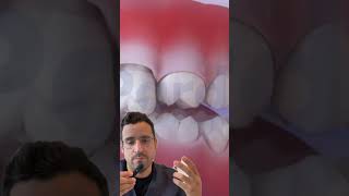 PERTE des DENTS  les conséquences dentaires [upl. by Beane]