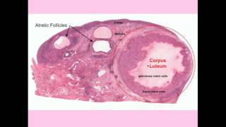 Ovarian Cysts  CRASH Medical Review Series [upl. by Ayiram]