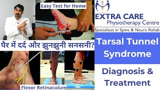 Tarsal Tunnel Syndrome in Hindi  Diagnosis and Treatment  Pain amp Tingling Sensation in Foot [upl. by Pawsner]