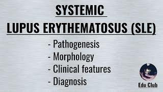 Systemic Lupus Erythematosus SLE  Pathogenesis  Morphology  Clinical  Diagnosis [upl. by Naz]