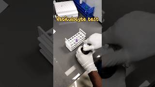 Reticulocyte count 🧑‍🔬🔬 medical lab Reticulocytecount youtubeshorts mbbs shortsmedicallabtech [upl. by Liana]