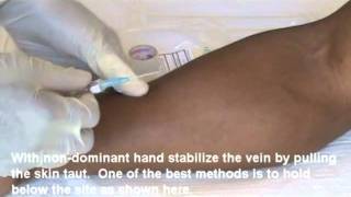 IV Insertion Video Demo 1 of 2mp4 [upl. by Estevan]