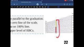 Hematocrit value  Practical hematology  Dr Saiko [upl. by Fisk]