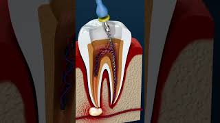 Cavity filling dentist teeth anatomy neet usmlestep [upl. by Siderf]